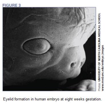 eye development week5 cross section