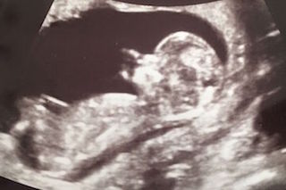 gender determination bc2e2a80fae06512
