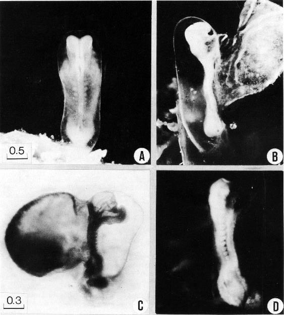 mudgha embryo carnegie stage10